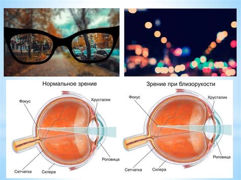Оптимизация зрения: проблемы и методы диагностики