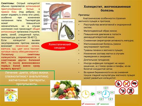 Организация правильного режима питья для профилактики желчекаменной болезни