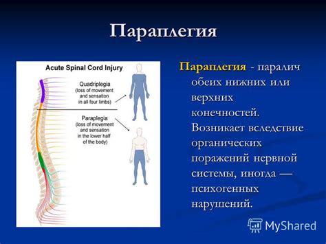 Ослабление или паралич конечностей