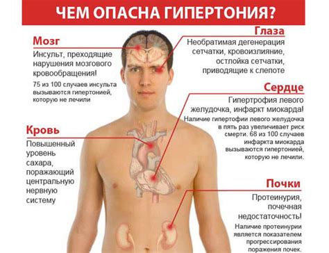 Осложнения при гипертонии