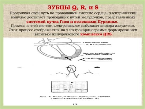 Основные признаки и методы определения S-типа на электрокардиограмме у молодых пациентов