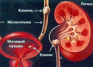 Основные признаки присутствия опухоли в мочевом органе у представителей мужского пола