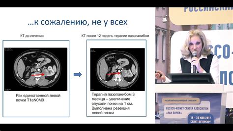 Основные принципы лечения непрерывного пеленания