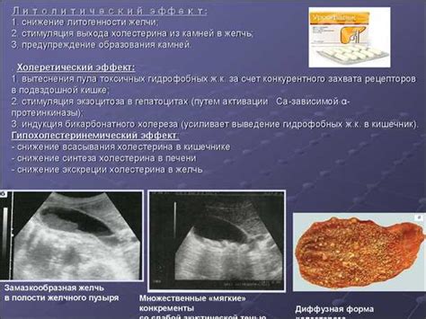 Основные принципы рациона при изгибе желчного мешка