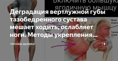 Основные причины неприятных сокращений мышц бедра