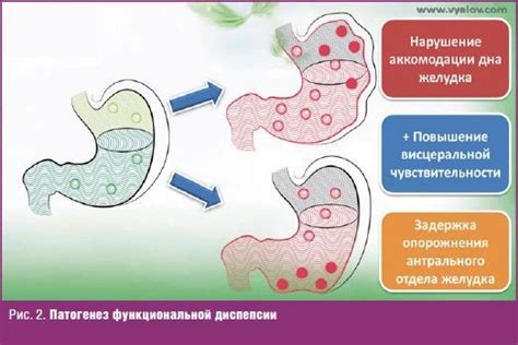 Основные причины несварения