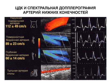 Основные различия при исследовании состояния ног с помощью УЗДГ и УЗДС