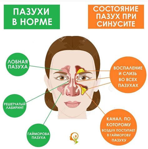 Основные симптомы заболеваний носа