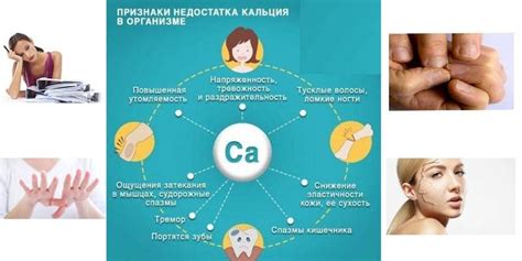 Основные симптомы недостатка кальция в организме