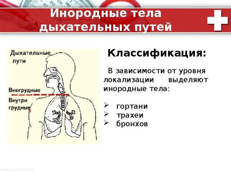 Основные факторы, способствующие образованию слизи в дыхательных путях