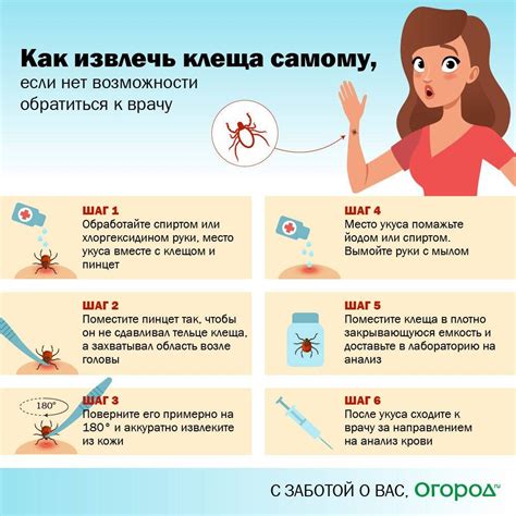 Основные этапы безопасной обработки укуса клеща