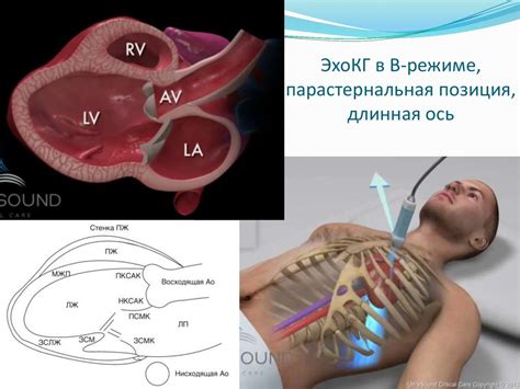 Основы эхокардиографии: принцип работы и важность метода
