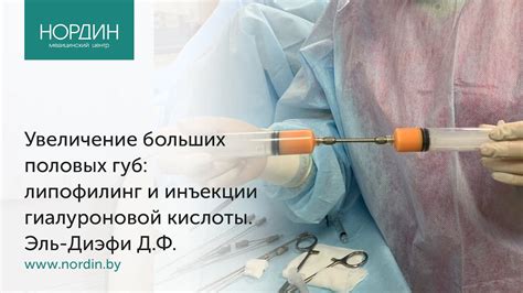 Патологическое увеличение половых губ: за что это может быть вызвано?