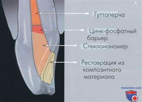 Побелите поверхность с помощью отбеливающего состава