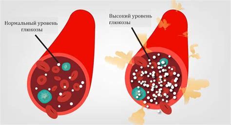 Повышенный уровень глюкозы: причины и последствия