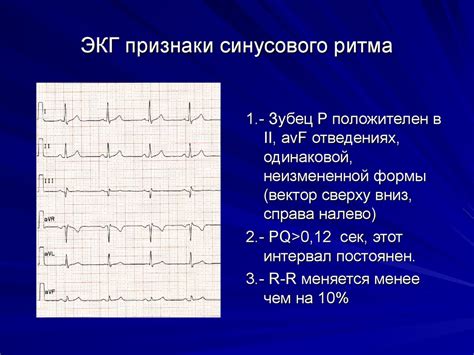 Полезная информация о проявлениях одиночного ритма суперсистолии на ЭКГ