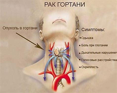 Понять признаки внутреннего кровосбора в голове