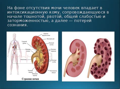 Последствия отсутствия мочи в произведениях