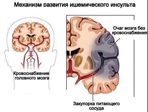 После проведения исследования головного мозга: советы и возможные последствия