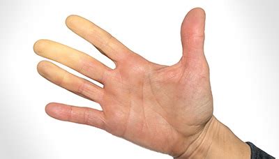 Почему пальцы левой руки не слушаются