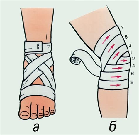 Правила установки и снятия плотной повязки на ноге