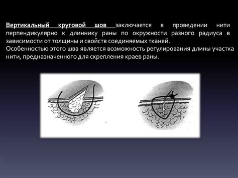 Превосходства и недостатки различных хирургических подходов в достижении выразительности скул