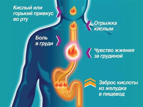 Признаки изжоги у совиных: