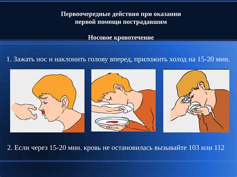 Применение пресс-метода для справления с носовым кровотечением