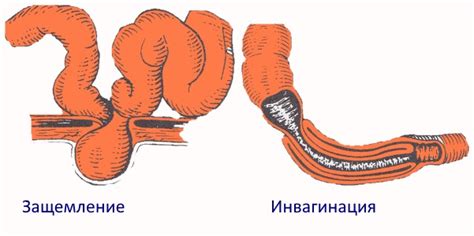 Причины возникновения кровотечения из аурального прохода