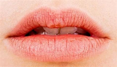 Причины возникновения неясного ощущения на правой стороне верхней губы