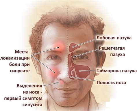 Причины возникновения носовых заболеваний: что приводит к развитию болезней в носу