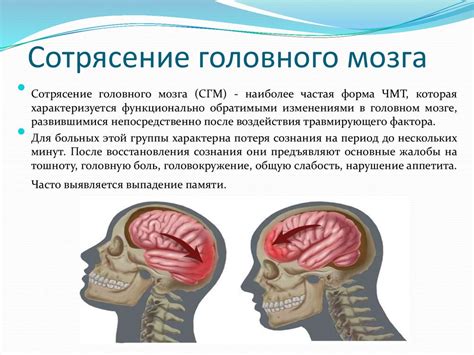 Причины возникновения рентгеновского сотрясения и его сущность