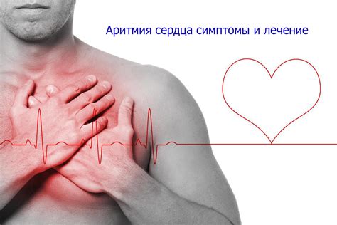 Причины и симптомы нестабильного ритма сердца