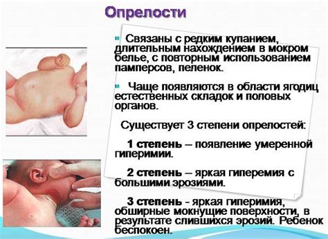 Причины и способы определения опрелостей в области под мышками у новорожденных