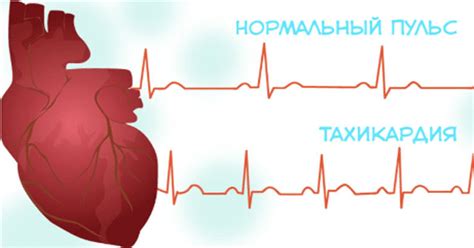 Причины нерегулярного сердцебиения