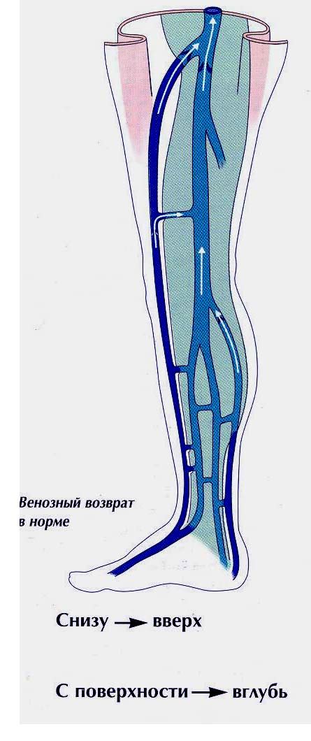 Причины несостоятельности перфорантных вен