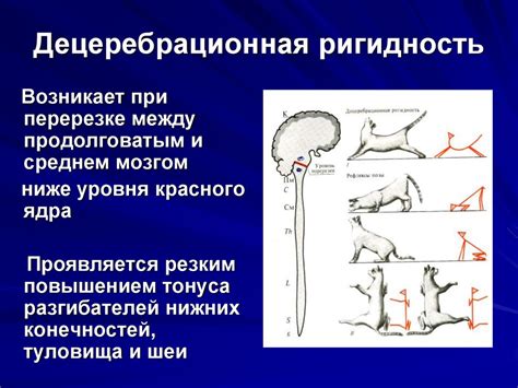 Проблемы с речью и общением: вызванные патологией движений и мышечного тонуса