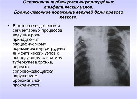 Прогноз заболевания и возможные осложнения при поражении правого легкого