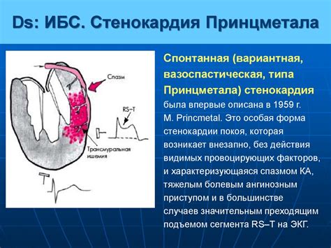 Прогноз и возможные осложнения при сокращении времени PQ у детей