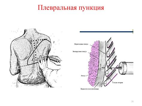 Профилактика возникновения воспалений при пункции ушей маленького пациента