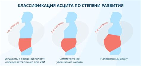 Профилактика напряженности брюшной области и правильное движение