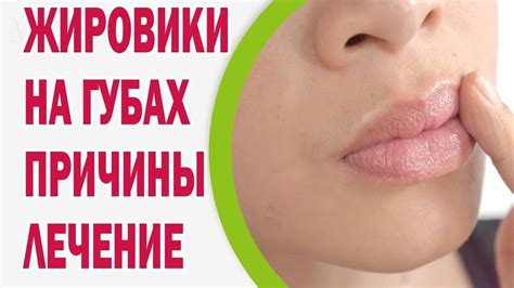 Профилактика неприятностей на губах: рекомендации для предотвращения проблем