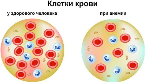 Различия в уровне гемоглобина у мужчин и женщин: основные факторы и физиологические причины