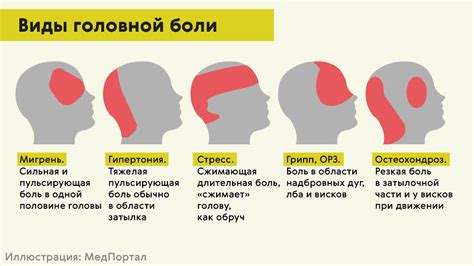 Разнообразие и значения маркировки на передней части головы у представителей разных полов