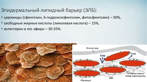 Разрушение гидролипидного барьера кожи