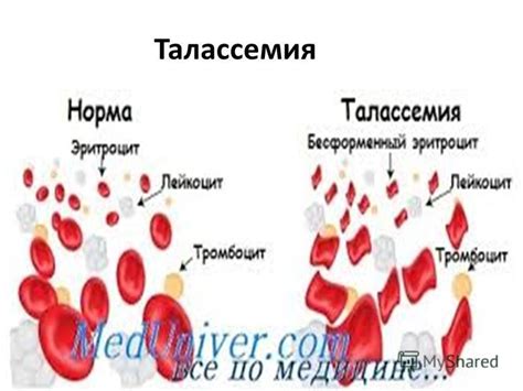 Расстройства в процессе синтеза гемоглобина