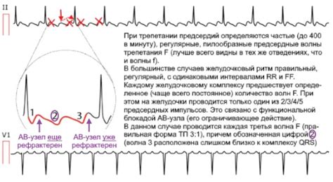 Режимы и настройки, определяющие трепетание и вспышку