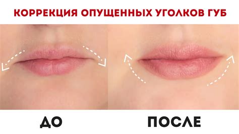 Рекомендации для успокоения дискомфорта на правой стороне верхней губы