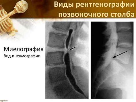 Рентгенография позвоночного столба: видение скрытых проблем