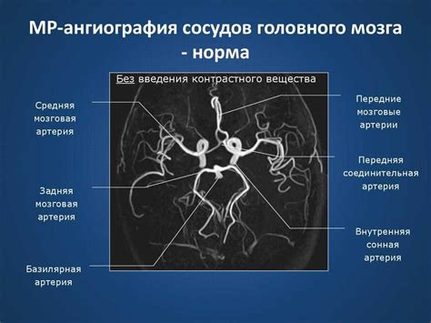 Риски и возможные последствия ангиографии головного мозга: что важно знать